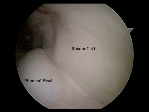 Normal Rotator Cuff