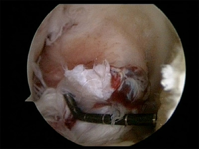 Tool showing Tear