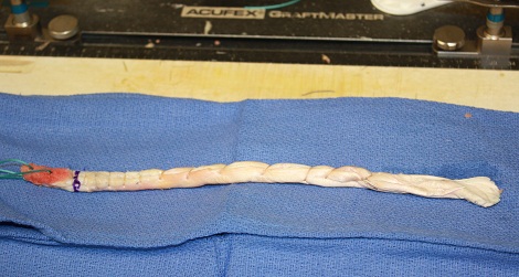 Achilles Tendon Allograft in the ACL Injuries